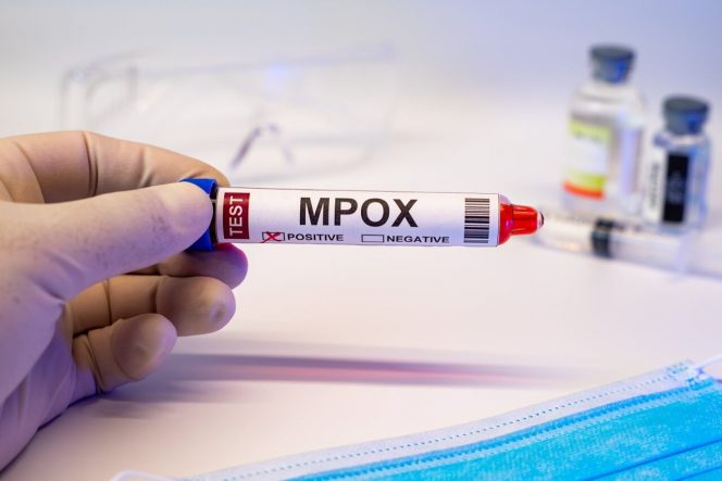 Първи случаи на новия вариант на mpox в САЩ и Канада